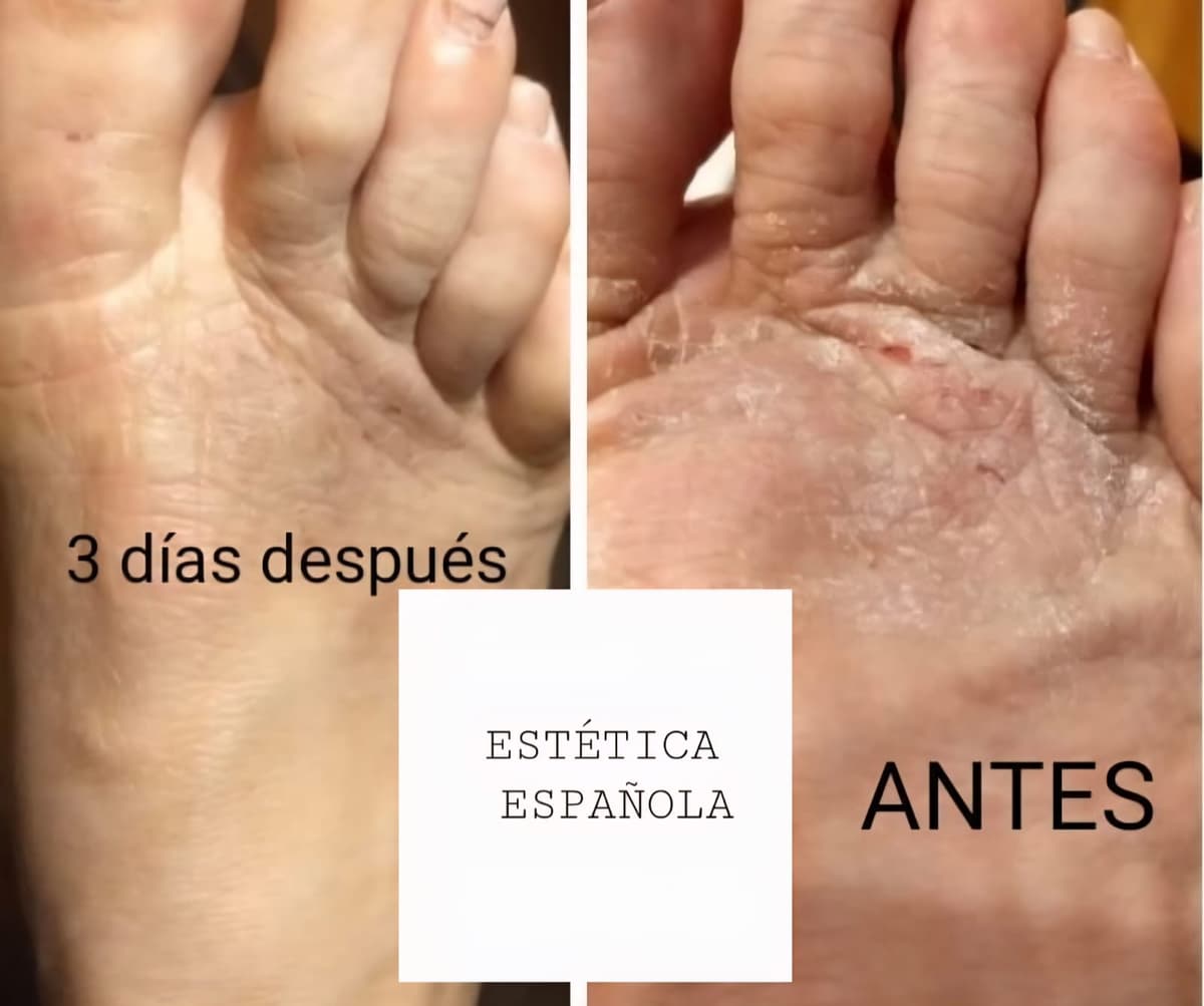 Tratamiento Podal — Estética Española